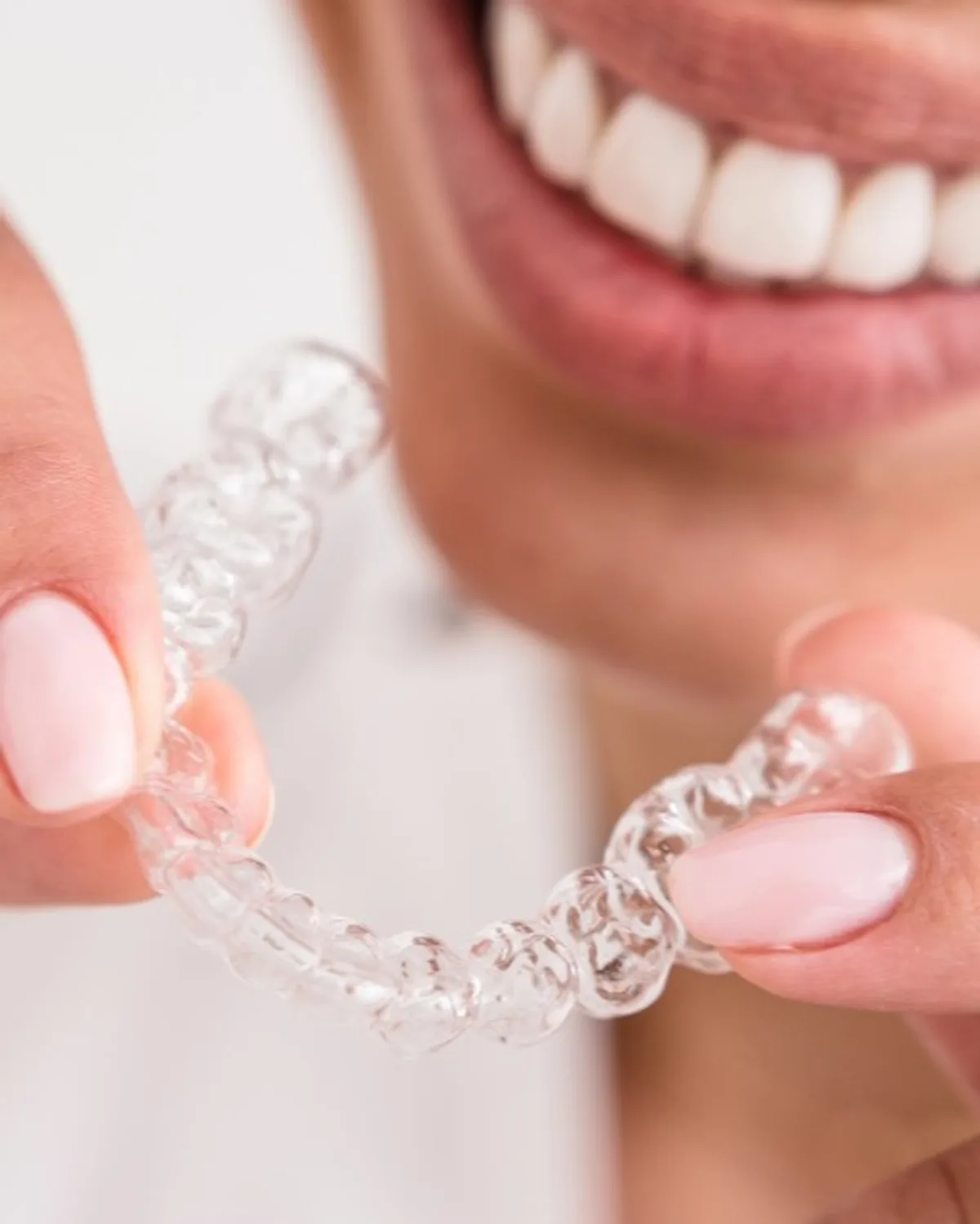 Clear aligner held up to a smiling patient at Ivory Dental Kepong