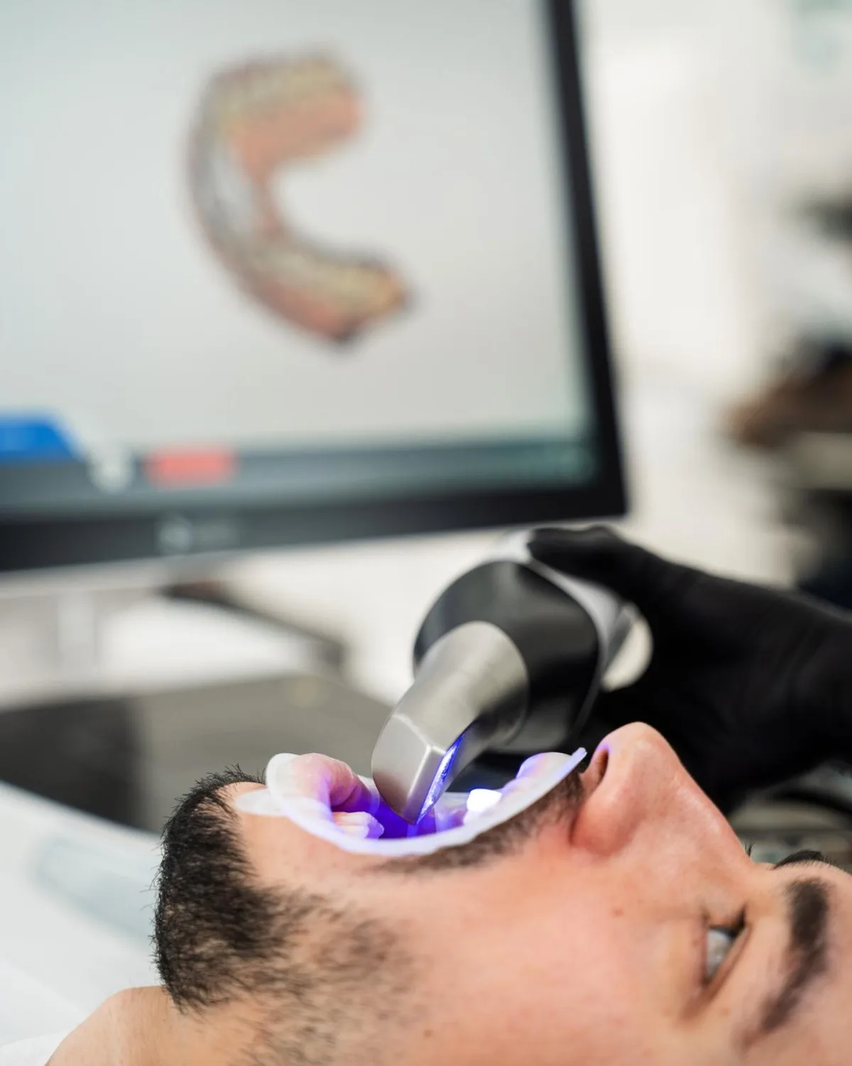 Intraoral scanner in use at Ivory Dental Kepong