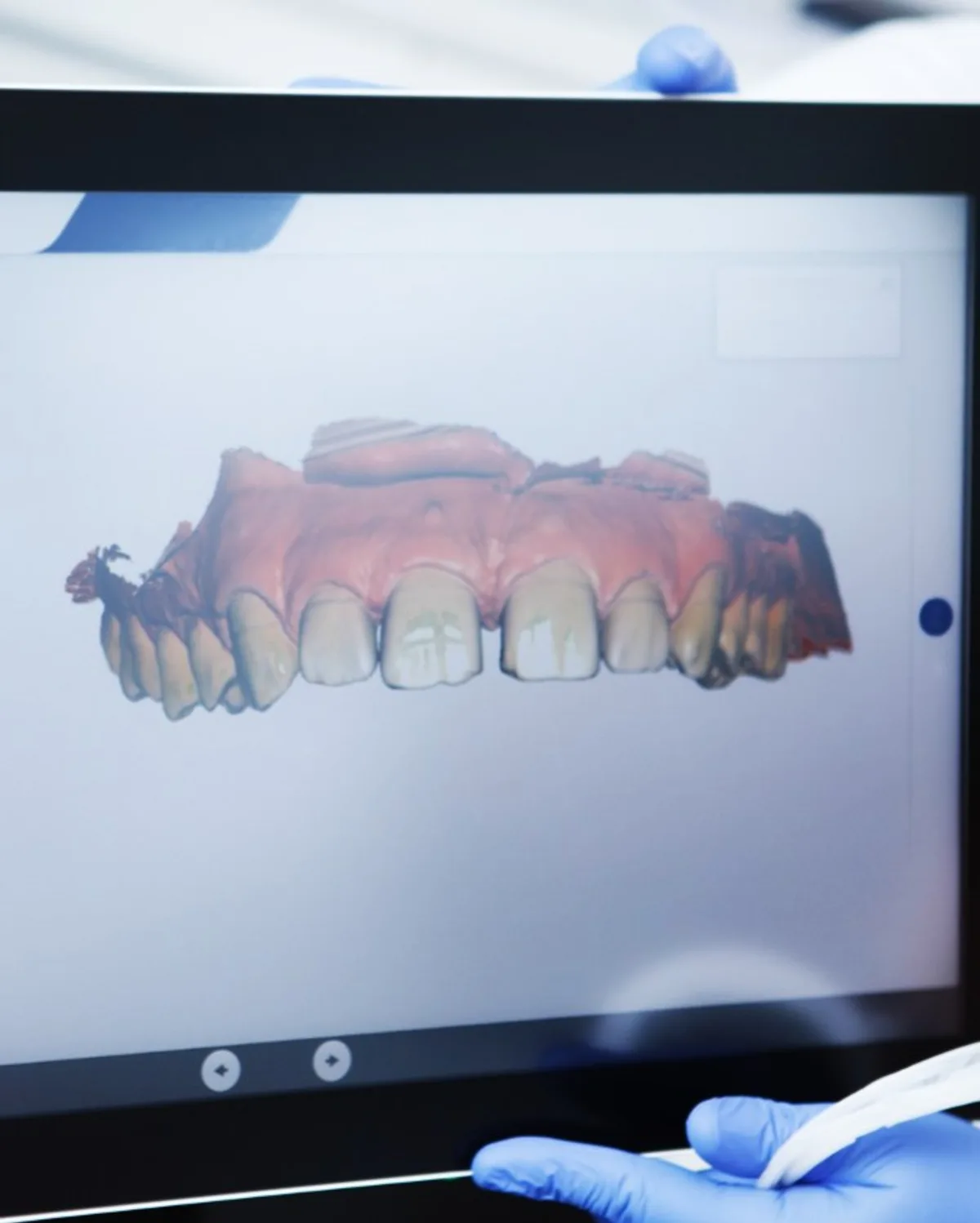 Digital X-ray scan review at Ivory Dental Kepong